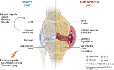 Mesenchymal stem cell-derived exosomes as a promising cell-free therapy for knee osteoarthritis